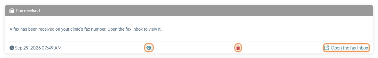 Set as not read, Delete and link actions at the bottom of a notification