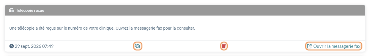 Actions Définir comme non lu, Supprimer et lien au bas d'une notification