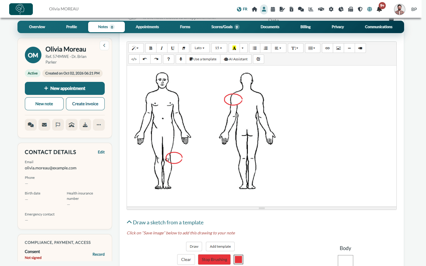 Drawing added as an image in the note editor